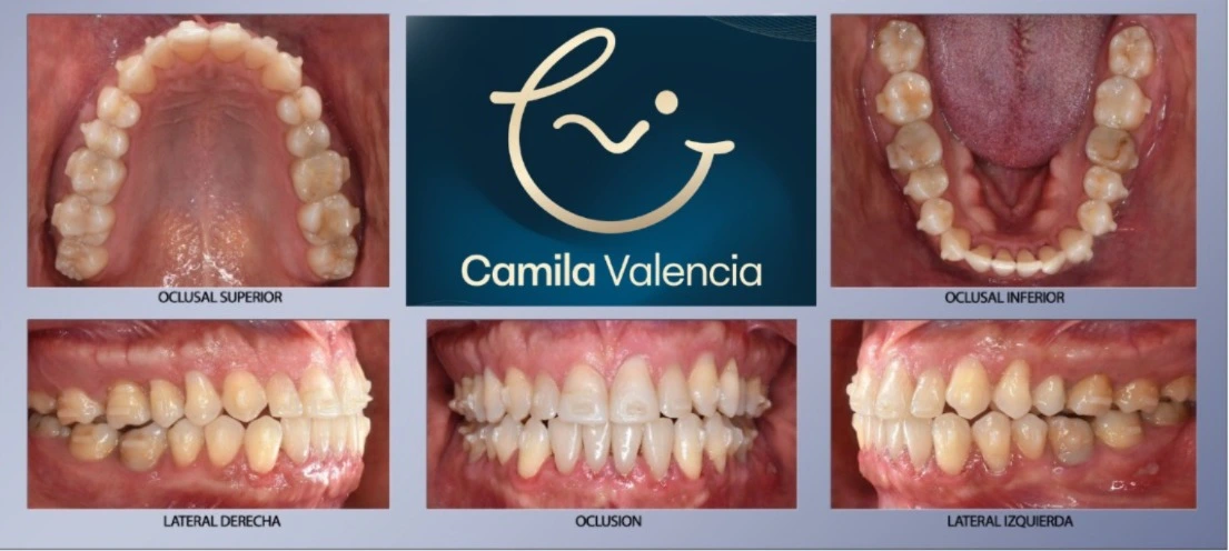 Diseño 3D
